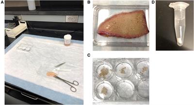 Functional human skin explants as tools for assessing mast cell activation and inhibition